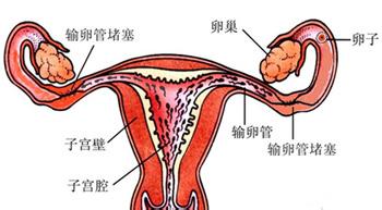 输卵管堵塞会排卵吗