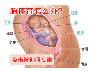 胎停育后做什么检查？能不能治好？